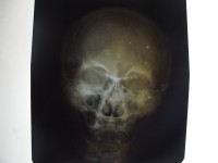 /album/galeria-de-fotos-museu-da-loucura/dscf0060-jpg/