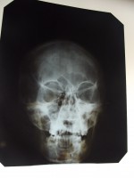 /album/galeria-de-fotos-museu-da-loucura/dscf0062-jpg/