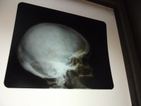 /album/galeria-de-fotos-museu-da-loucura/dscf0063-jpg/